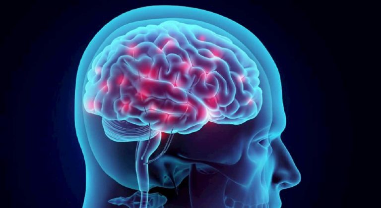 Постконтузійний синдром: чому «пройде само» не працює і симптоми повертаються знову