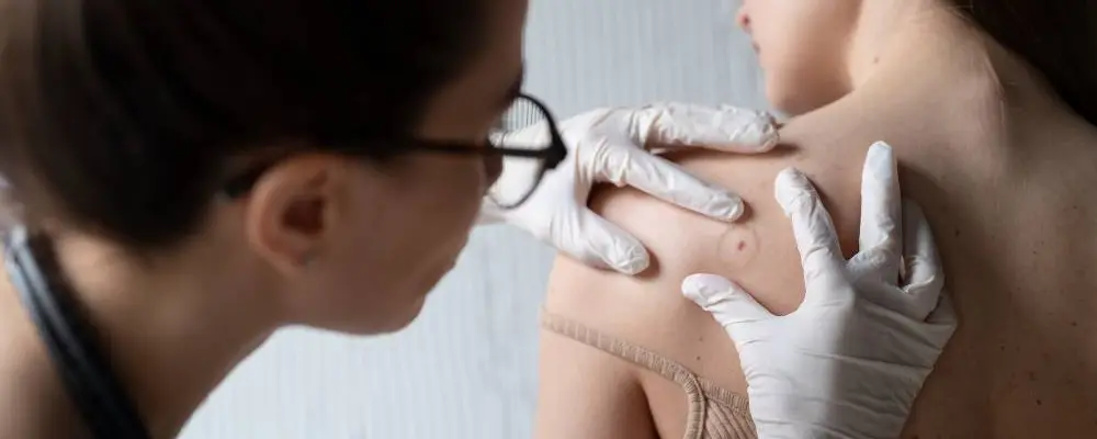 Коли варто відвідати дерматолога