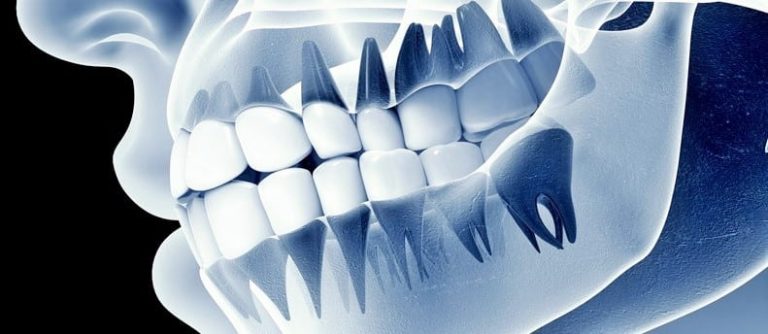 Рентген апарати: сучасні рішення від Прем’єр-Дентал